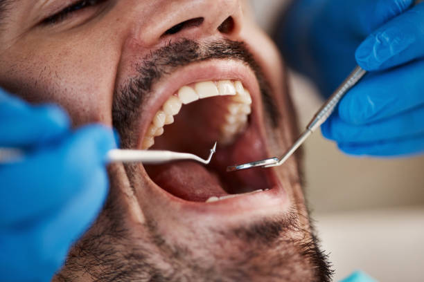 Best Emergency Denture Repair in Benton City, WA